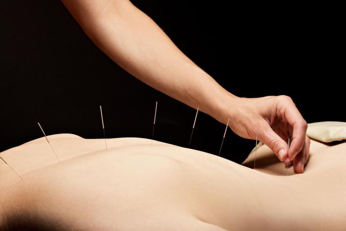 Acupuncture Points - SIT Acupuncture